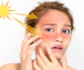 تاثیر اشعه ماورای بنفش بر روی پوست